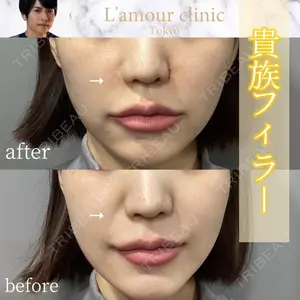 L‘amour clinic Tokyo【ラムールクリニック東京】 片岡 紘士医師の症例