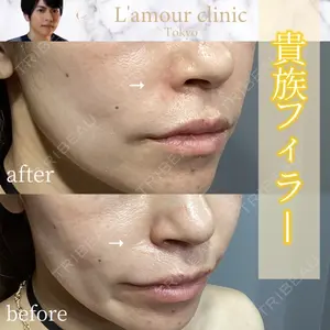 L‘amour clinic Tokyo【ラムールクリニック東京】 片岡 紘士医師の症例