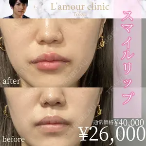 L‘amour clinic Tokyo【ラムールクリニック東京】 片岡 紘士医師の症例