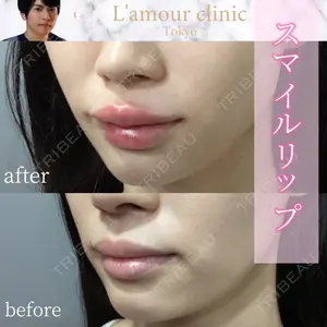 L‘amour clinic Tokyo【ラムールクリニック東京】 片岡 紘士医師の症例