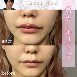 L‘amour clinic Tokyo【ラムールクリニック東京】 片岡 紘士医師の症例