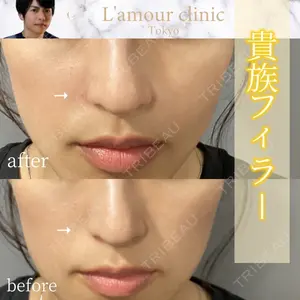 L‘amour clinic Tokyo【ラムールクリニック東京】 片岡 紘士医師の症例