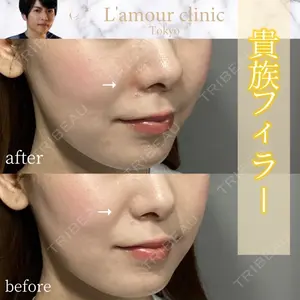 L‘amour clinic Tokyo【ラムールクリニック東京】 片岡 紘士医師の症例