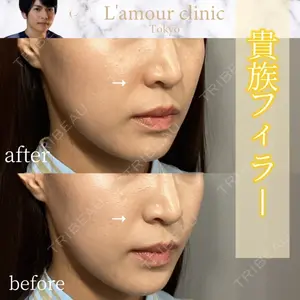 L‘amour clinic Tokyo【ラムールクリニック東京】 片岡 紘士医師の症例