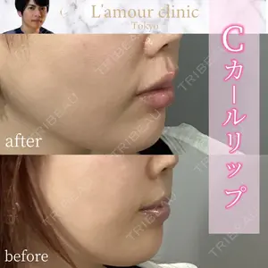 L‘amour clinic Tokyo【ラムールクリニック東京】 片岡 紘士医師の症例