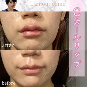 L‘amour clinic Tokyo【ラムールクリニック東京】 片岡 紘士医師の症例