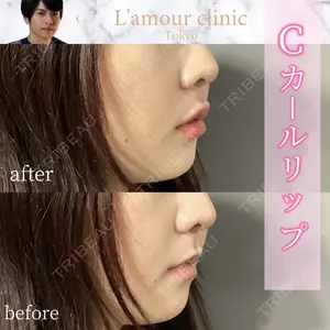 L‘amour clinic Tokyo【ラムールクリニック東京】 片岡 紘士医師の症例