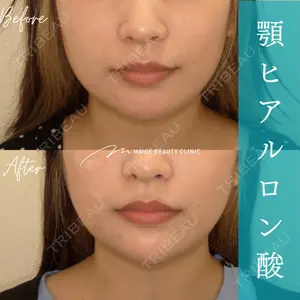 Mavie Beauty Clinic （マヴィービューティークリニック） 渡邉 憲一郎医師の症例