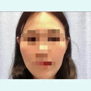 NANA（ナナ）美容外科 キム・ヒョンジュン医師の症例