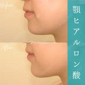 Mavie Beauty Clinic （マヴィービューティークリニック） 渡邉 憲一郎医師の症例