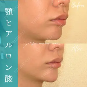 Mavie Beauty Clinic （マヴィービューティークリニック） 渡邉 憲一郎医師の症例