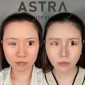 ASTRA BEAUTY CLINICの症例