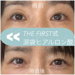 THE FIRST CLINIC 多摩センター院 惟村 公郁医師の症例