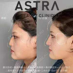 ASTRA BEAUTY CLINICの症例