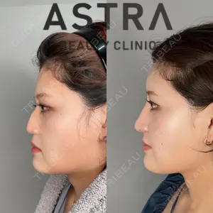 ASTRA BEAUTY CLINICの症例