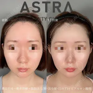 ASTRA BEAUTY CLINIC 塩満 惠子医師の症例