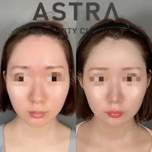 ASTRA BEAUTY CLINIC 塩満 惠子医師の症例