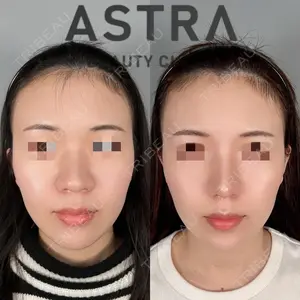 ASTRA BEAUTY CLINIC 塩満 惠子医師の症例