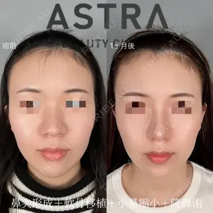 ASTRA BEAUTY CLINIC 塩満 惠子医師の症例