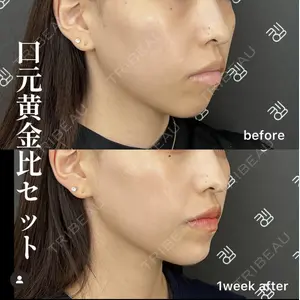 EMMO FACE CLINIC 大阪梅田院 山﨑 冴羅医師の症例