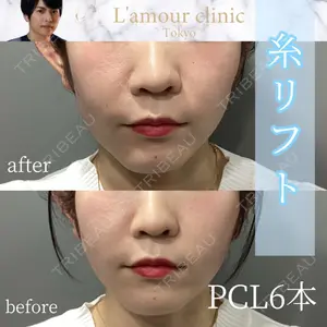 L‘amour clinic Tokyo【ラムールクリニック東京】 片岡 紘士医師の症例