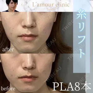 L‘amour clinic Tokyo【ラムールクリニック東京】 片岡 紘士医師の症例