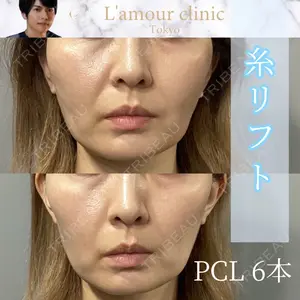 L‘amour clinic Tokyo【ラムールクリニック東京】 片岡 紘士医師の症例