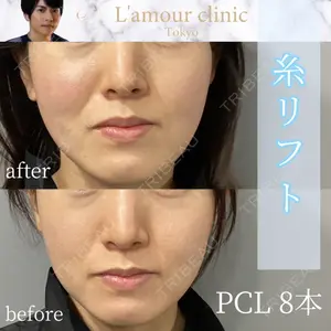 L‘amour clinic Tokyo【ラムールクリニック東京】 片岡 紘士医師の症例