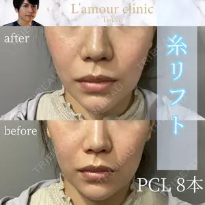 L‘amour clinic Tokyo【ラムールクリニック東京】 片岡 紘士医師の症例