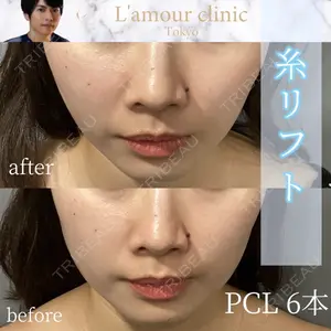 L‘amour clinic Tokyo【ラムールクリニック東京】 片岡 紘士医師の症例