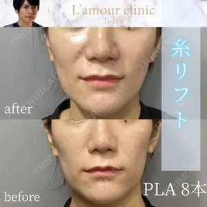 L‘amour clinic Tokyo【ラムールクリニック東京】 片岡 紘士医師の症例