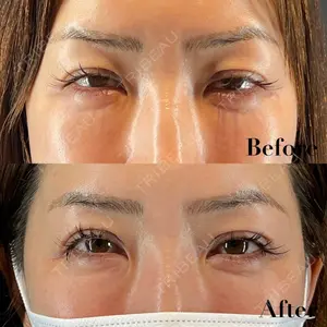 HAAB BEAUTY CLINIC 名古屋院の症例