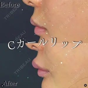 ルラ美容クリニック 渋谷本院 住友 沙織医師の症例