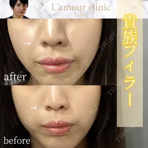 L‘amour clinic Tokyo【ラムールクリニック東京】 片岡 紘士医師の症例