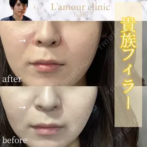 L‘amour clinic Tokyo【ラムールクリニック東京】 片岡 紘士医師の症例