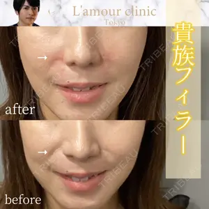 L‘amour clinic Tokyo【ラムールクリニック東京】 片岡 紘士医師の症例