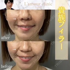 L‘amour clinic Tokyo【ラムールクリニック東京】 片岡 紘士医師の症例