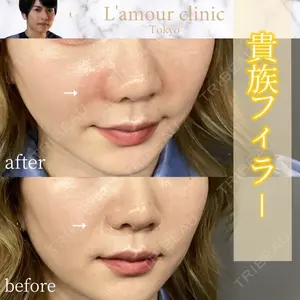 L‘amour clinic Tokyo【ラムールクリニック東京】 片岡 紘士医師の症例