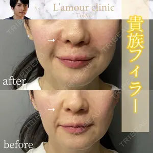 L‘amour clinic Tokyo【ラムールクリニック東京】 片岡 紘士医師の症例