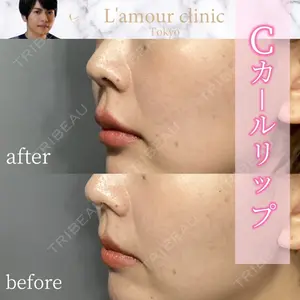 L‘amour clinic Tokyo【ラムールクリニック東京】 片岡 紘士医師の症例