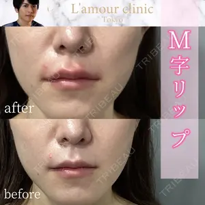 L‘amour clinic Tokyo【ラムールクリニック東京】 片岡 紘士医師の症例