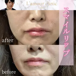 L‘amour clinic Tokyo【ラムールクリニック東京】 片岡 紘士医師の症例