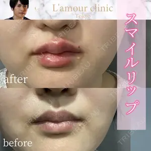 L‘amour clinic Tokyo【ラムールクリニック東京】 片岡 紘士医師の症例