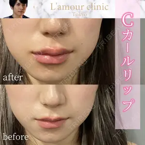 L‘amour clinic Tokyo【ラムールクリニック東京】 片岡 紘士医師の症例