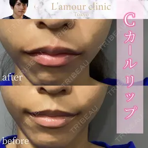 L‘amour clinic Tokyo【ラムールクリニック東京】 片岡 紘士医師の症例