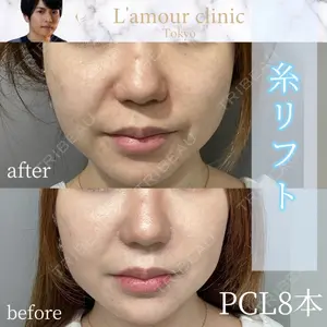 L‘amour clinic Tokyo【ラムールクリニック東京】 片岡 紘士医師の症例