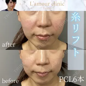 L‘amour clinic Tokyo【ラムールクリニック東京】 片岡 紘士医師の症例