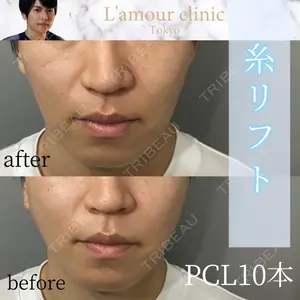 L‘amour clinic Tokyo【ラムールクリニック東京】 片岡 紘士医師の症例