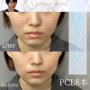 L‘amour clinic Tokyo【ラムールクリニック東京】 片岡 紘士医師の症例