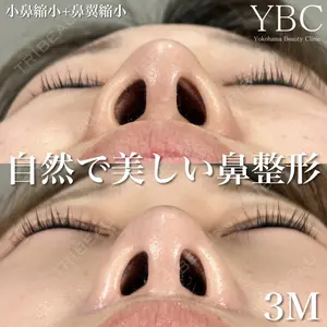 YBC横浜美容外科 大宮院 磯村 亮輔医師の症例